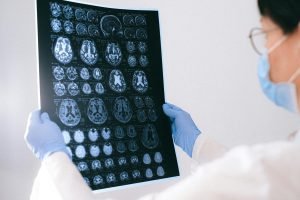 Médica segurando uma tomografia do cérebro