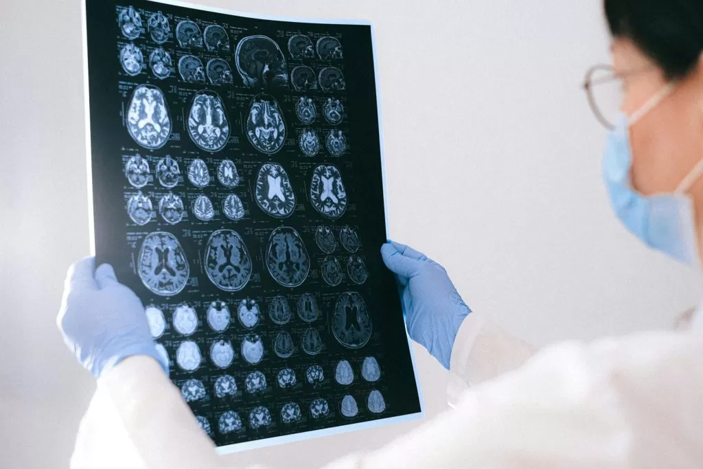 Médica segurando uma tomografia do cérebro