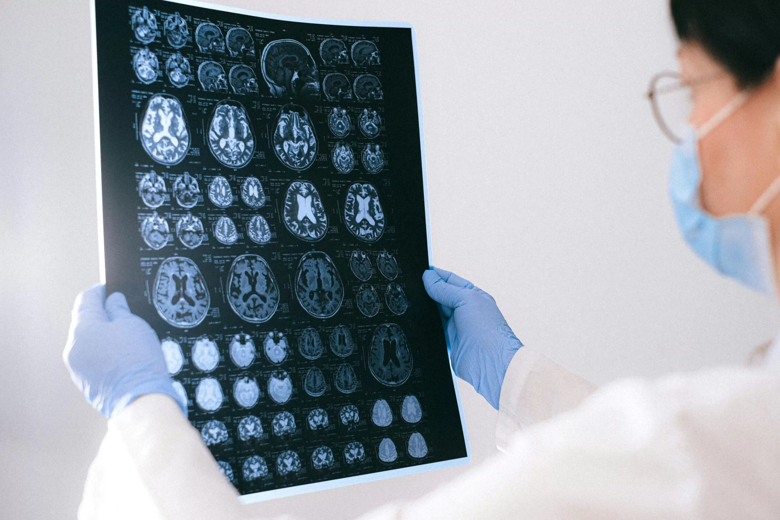 Médica segurando uma tomografia do cérebro